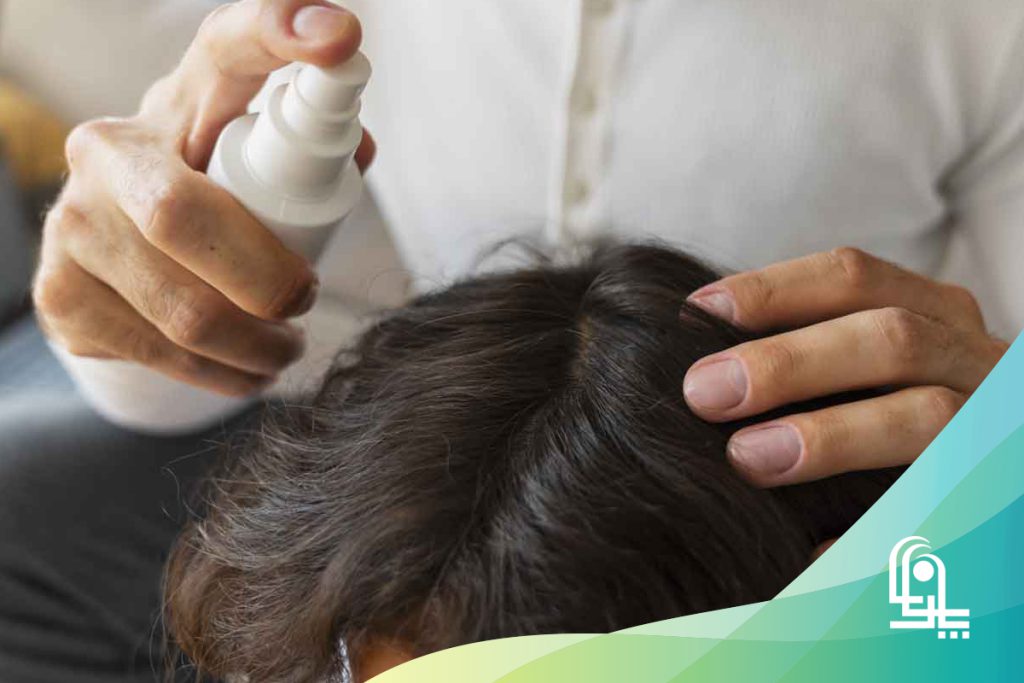 درمان قطعی شپش موی سر در خانه