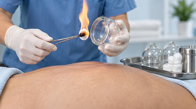 حجامت در پونک 3 کاربرد حجامت تهران | حجامت پونک برای چه کسانی خوبه؟ | نینی سایت